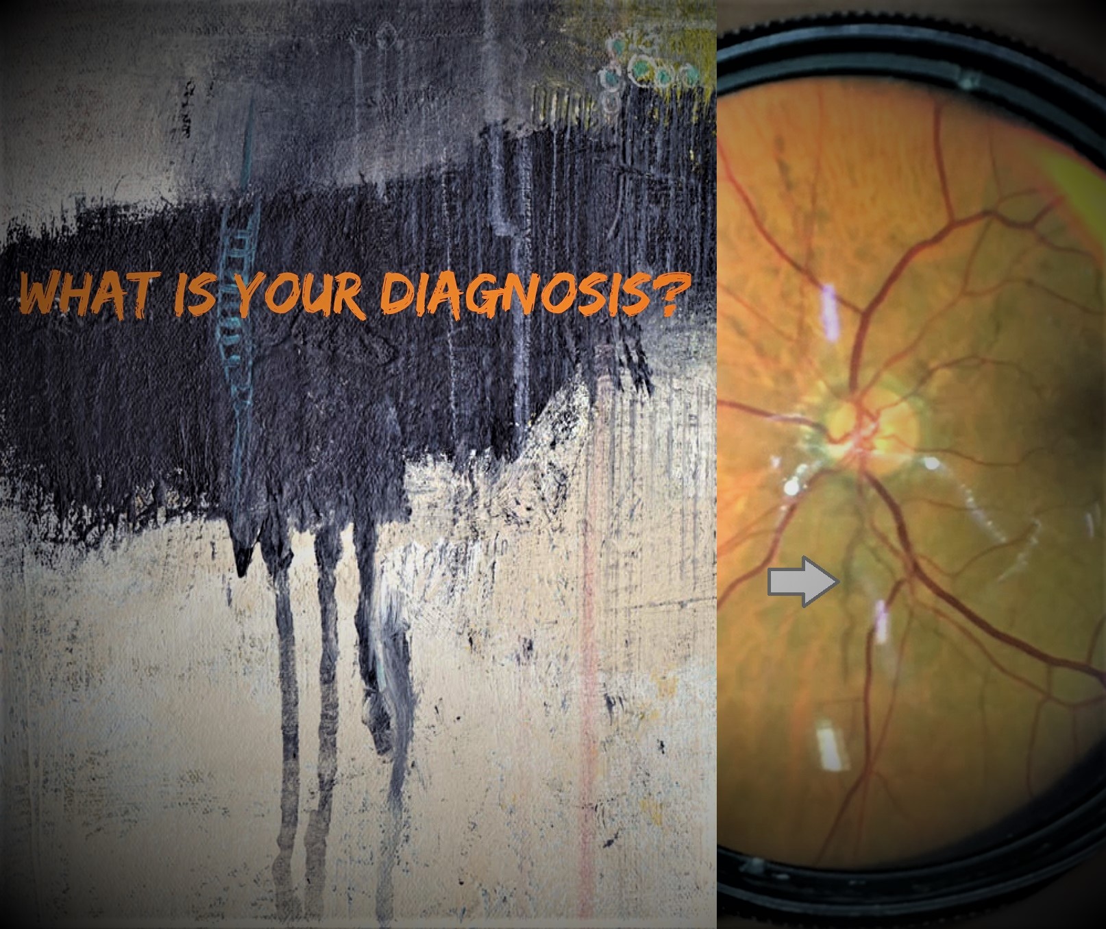 What is Your Diagnosis