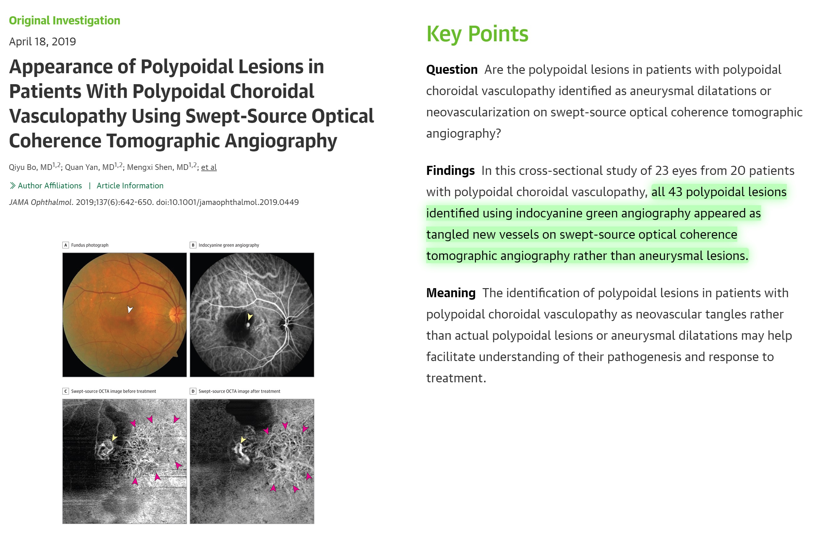 Previously described polypoidal lesions in PCV