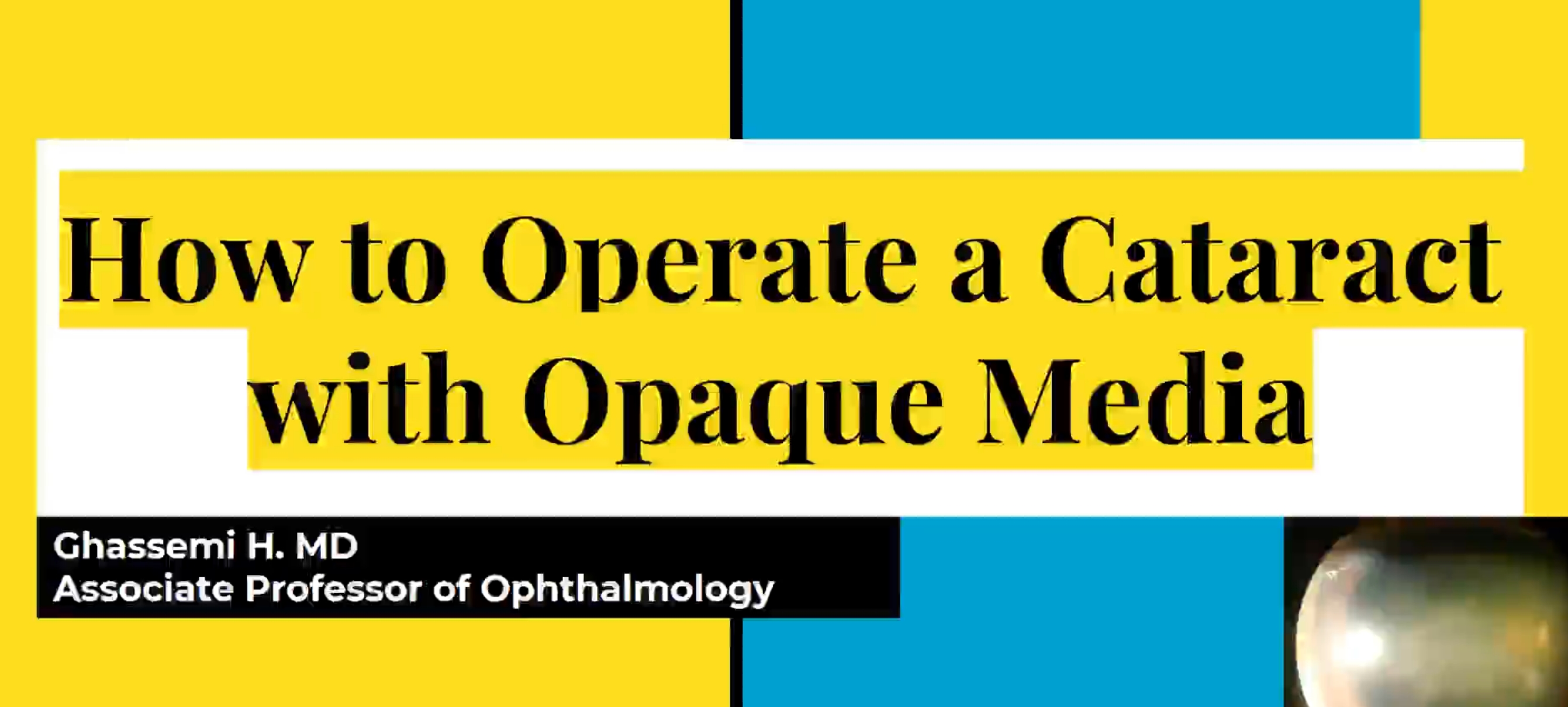 How To Operate Cataract with Opaque Media