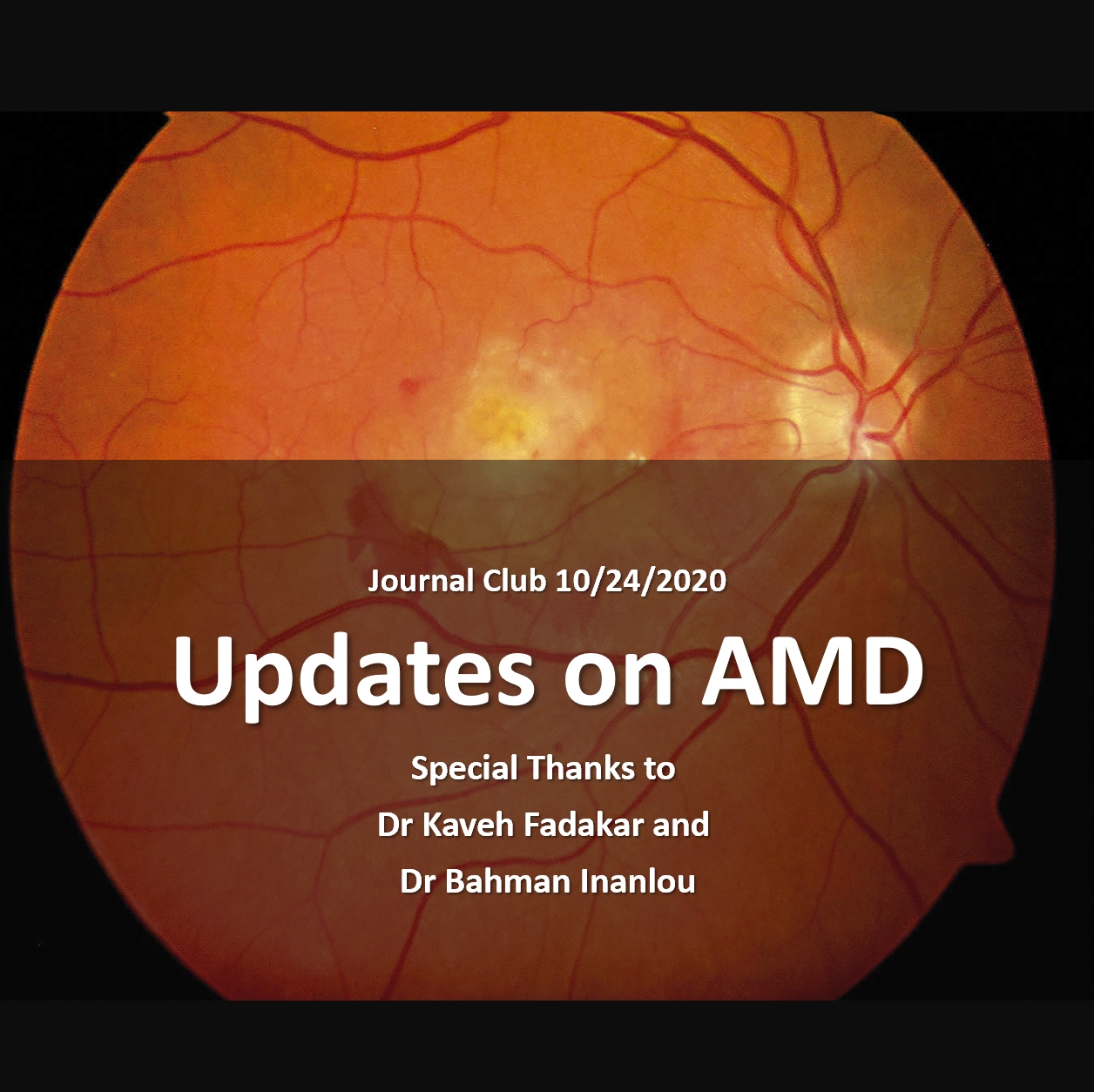 Updates on AMD
