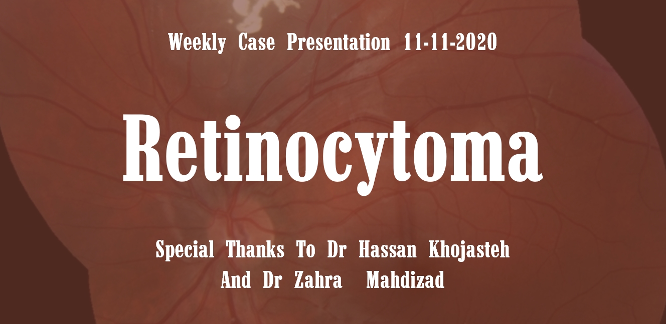 Retinocytoma