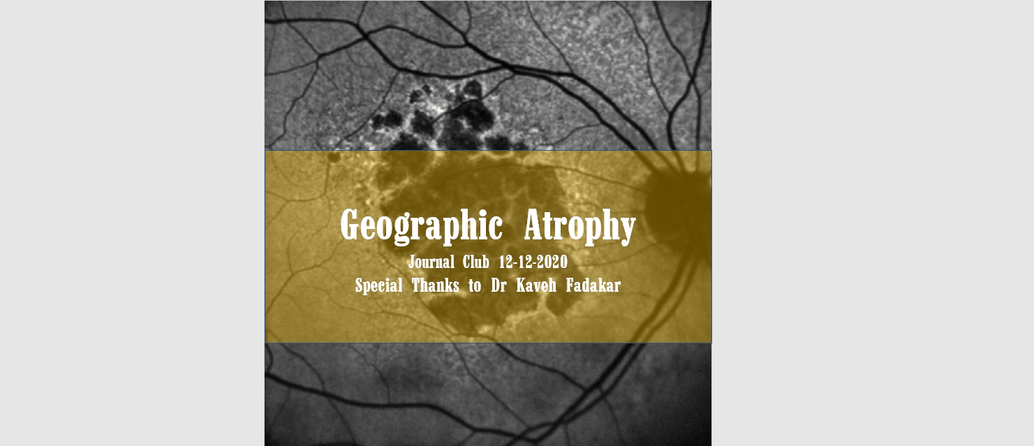 Geographic Atrophy