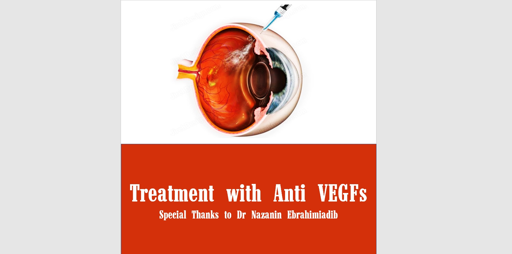 Treatment with Anti-VEGFs