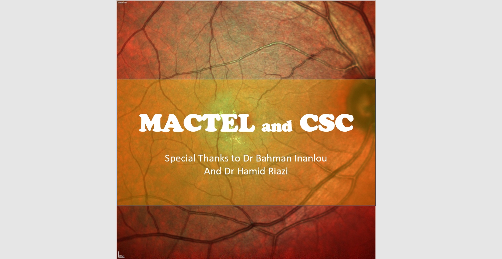 MACTEL and CSC
