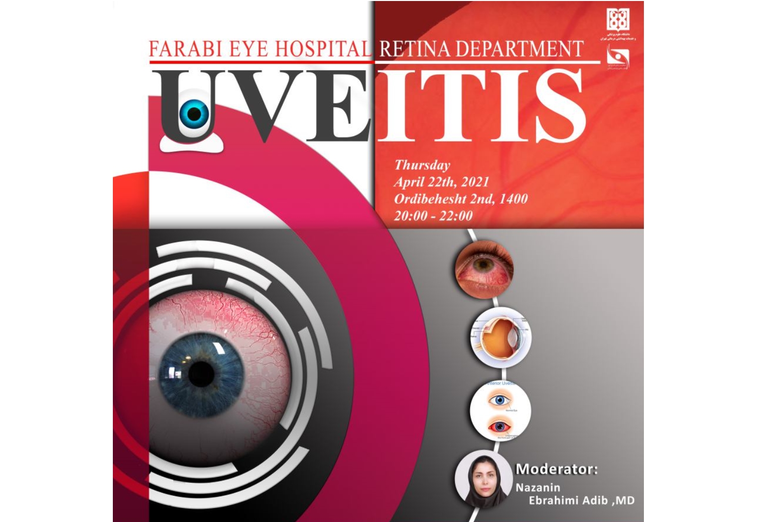 Uveitis Webinar