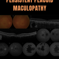 Persistent Placoid Maculopathy