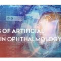 AI in Diabetic Retinopathy