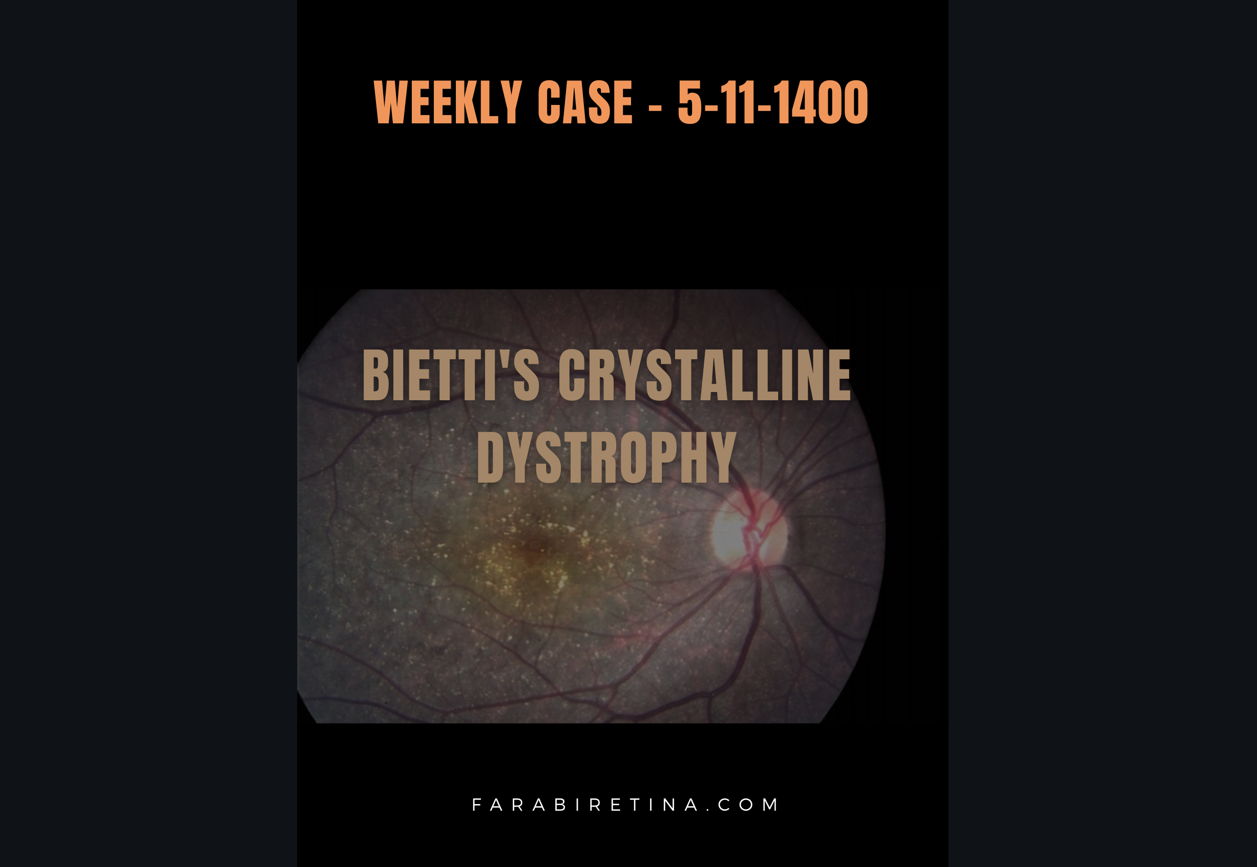 Weekly Case Presentation : 5-11-1400