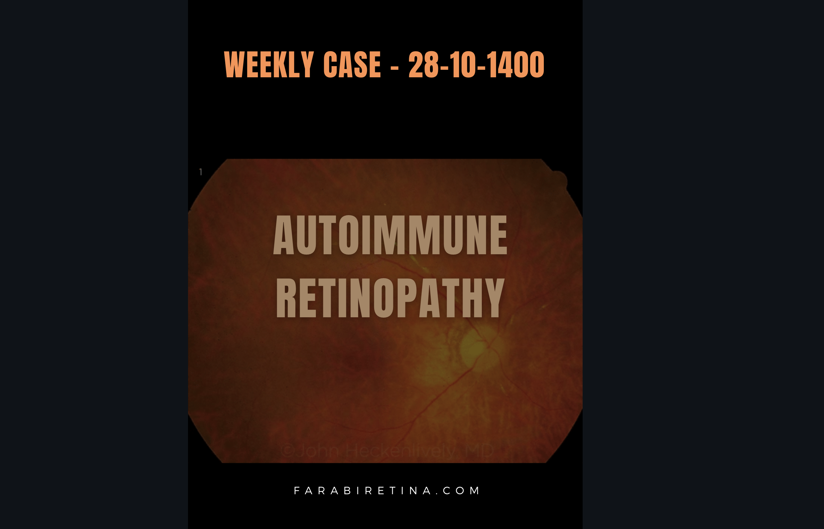 Weekly Case Presentation: 28-10-1400