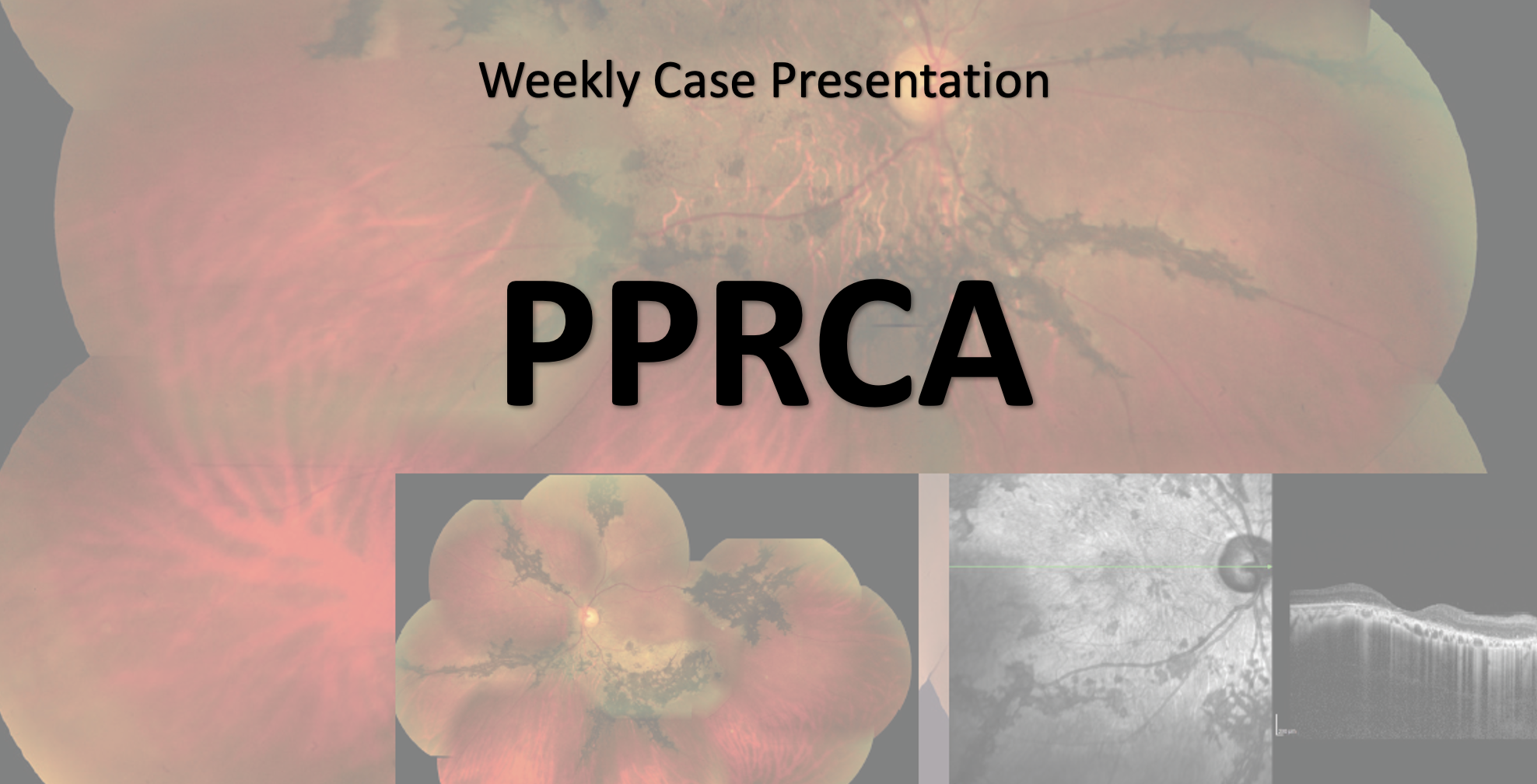 Weekly Case Presentation 1401-2-6