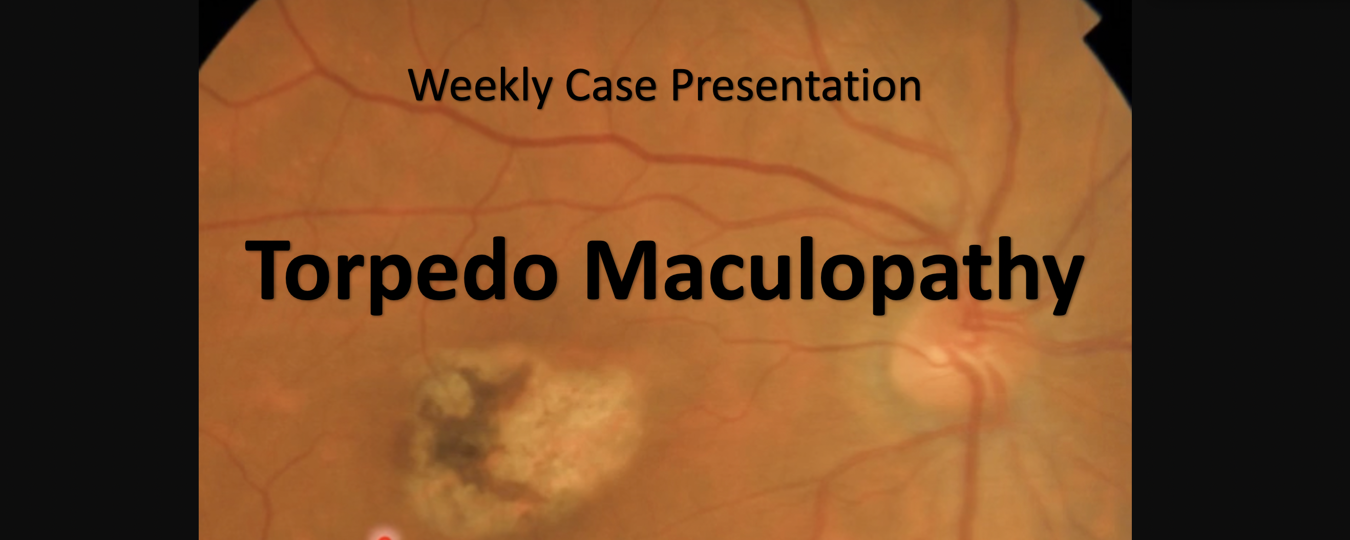 Weekly Case Presentation 1401-2-20