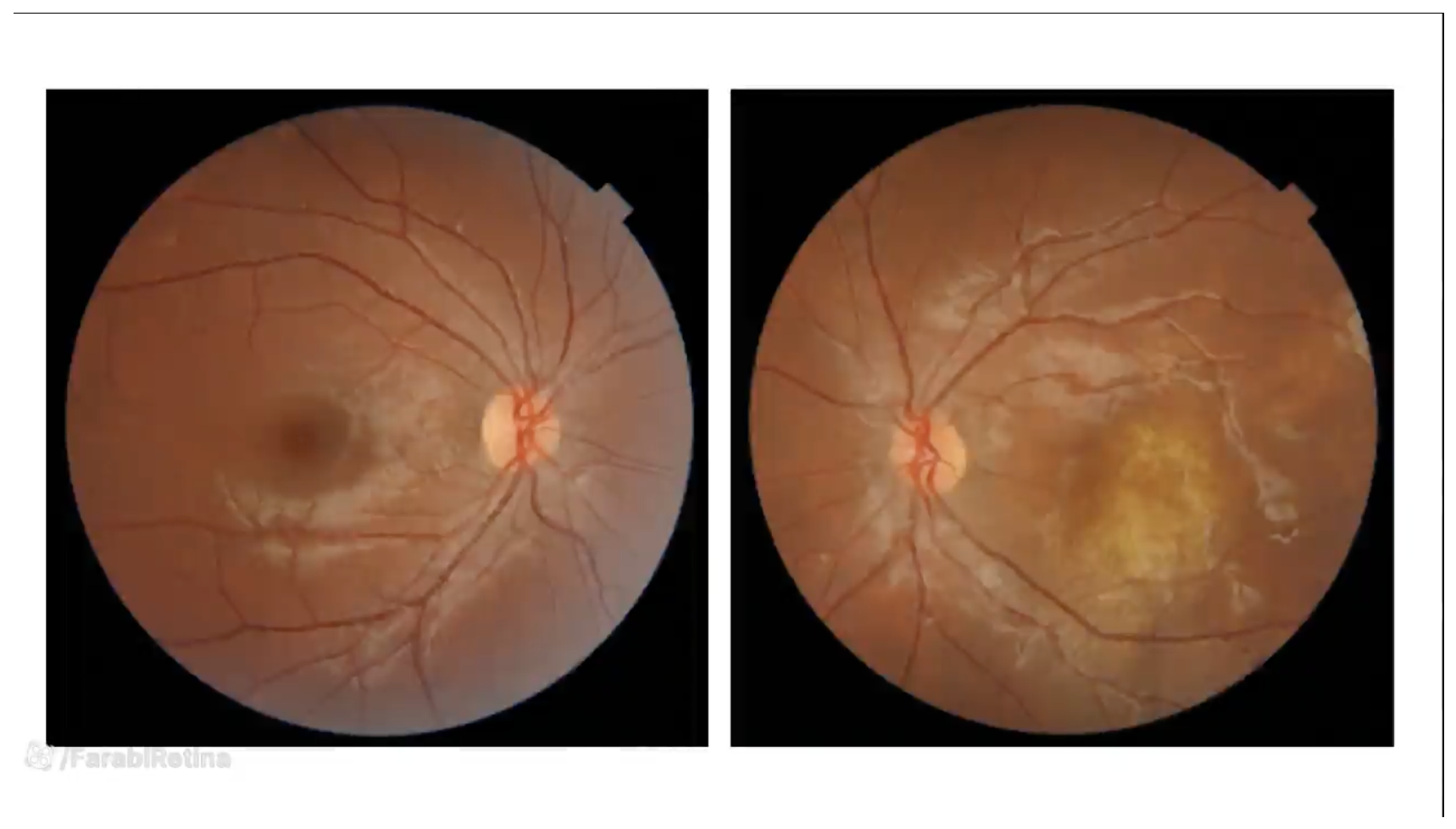 Weekly Case Presentation – 19-7-1401
