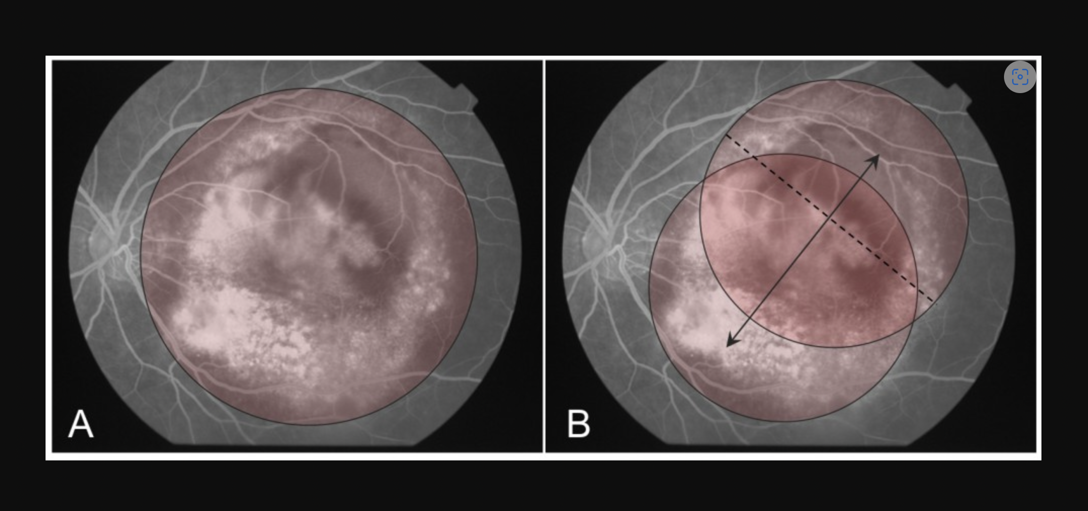 Weekly Case Presentation  24-8-1401