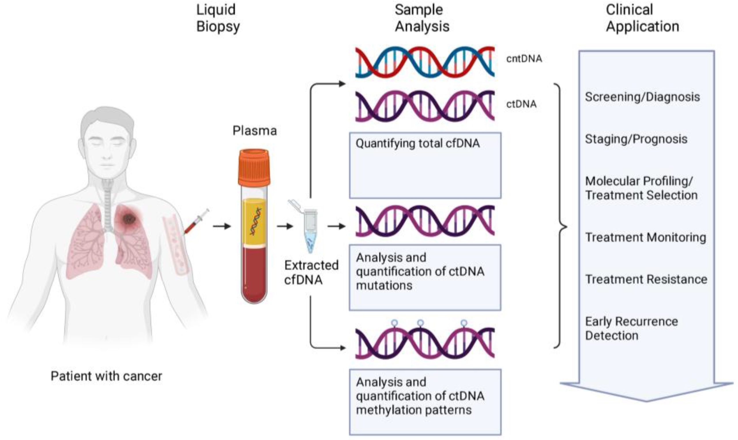 Blood Test Breakthrough: Plasma ctDNA Speeds Up Choroidal Metastasis Diagnosis