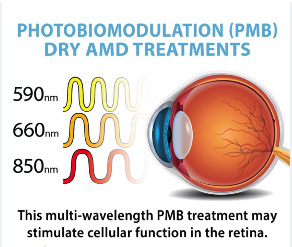 Shining a Light on Dry AMD: Photobiomodulation Therapy Offers Hope for Non-exudative Macular Degeneration