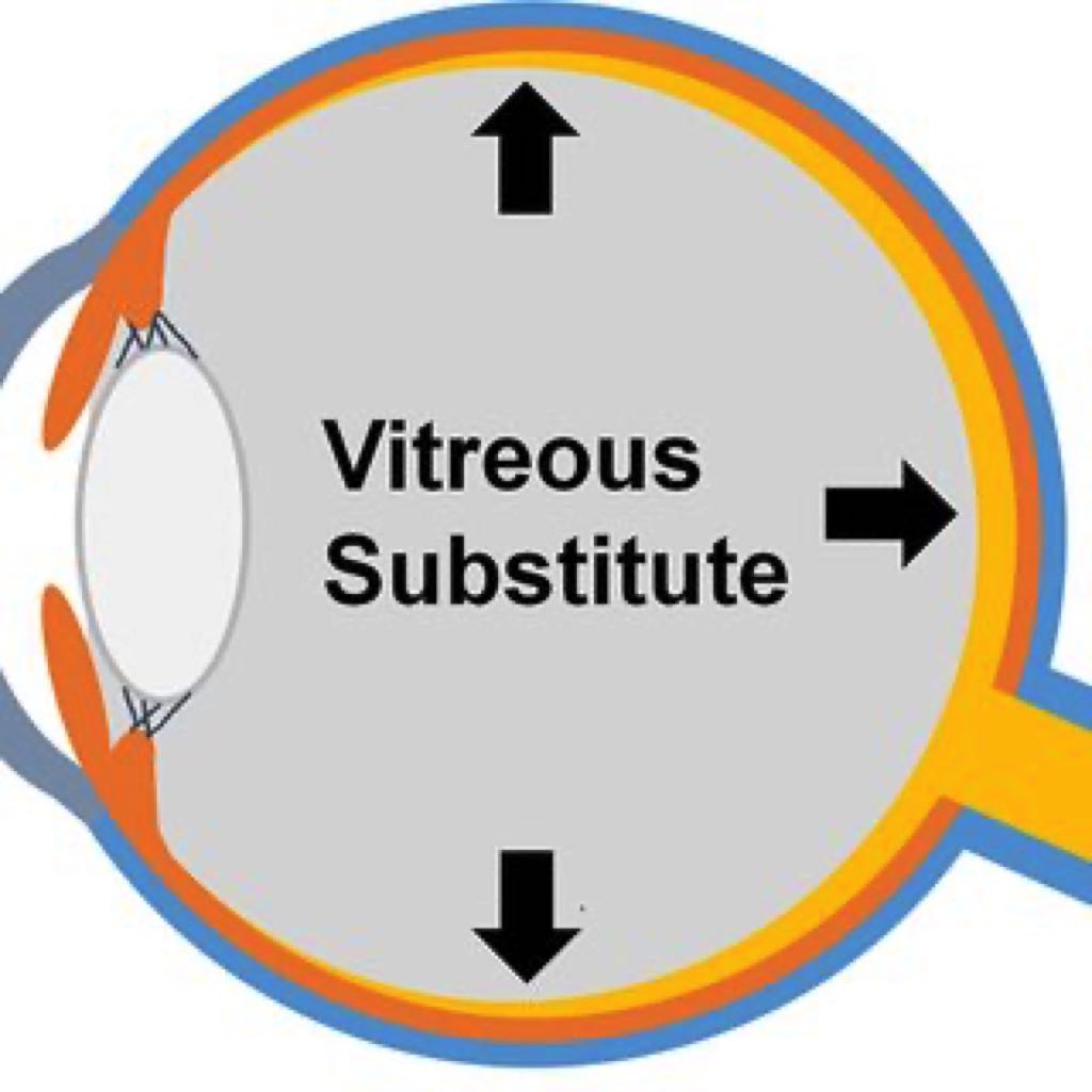 Vitreous Substitutes and Tamponades